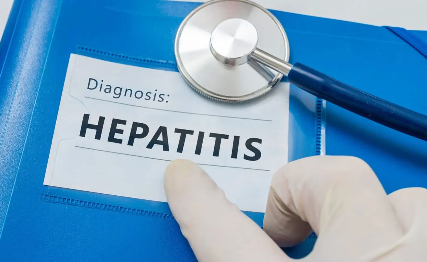 Hepatitis B: A Looming Threat - Expert Reveals Infection Rate 100 Times Higher than HIV